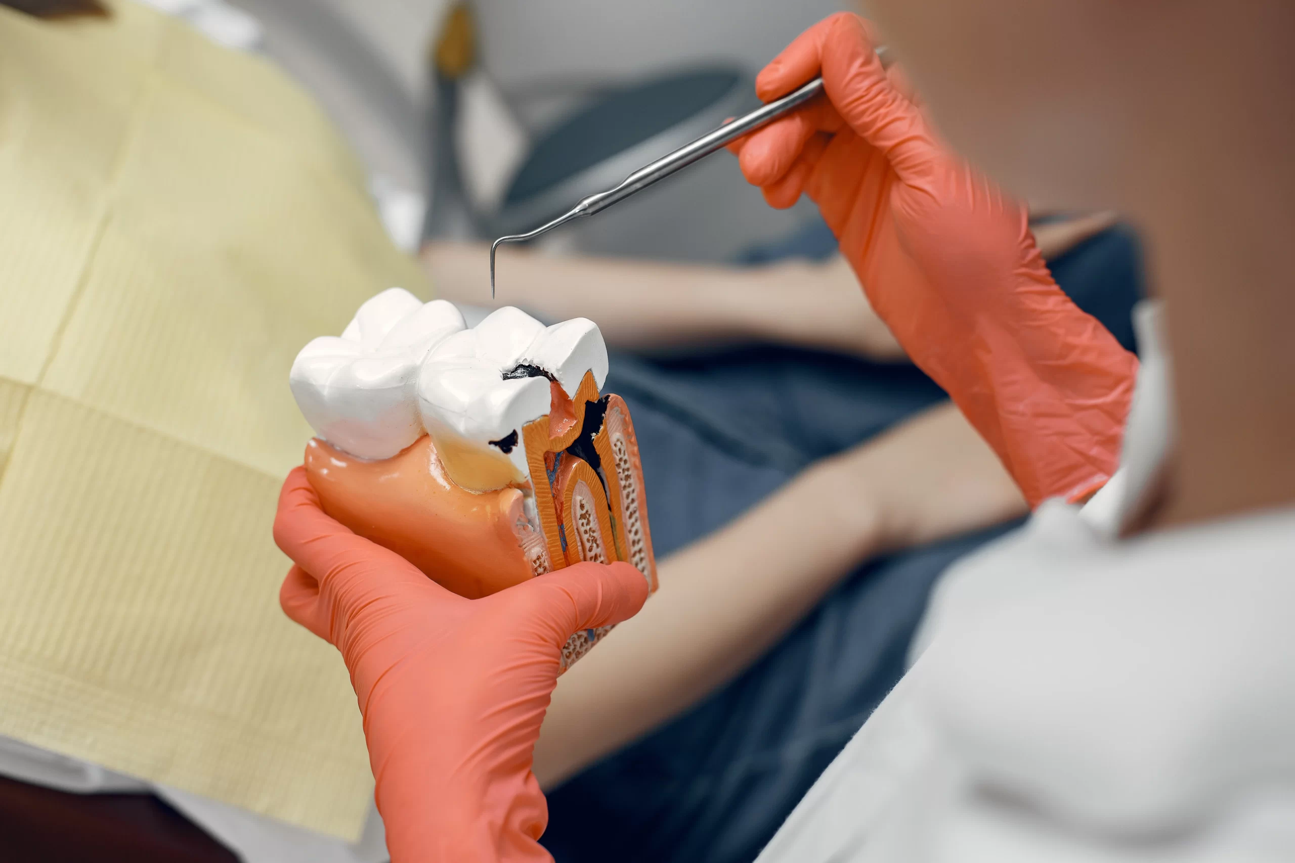 3D Molar Extraction